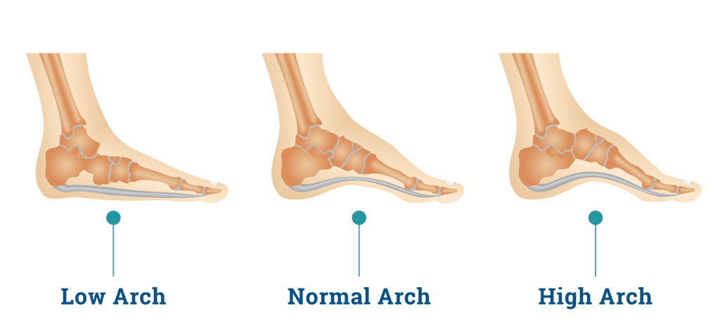 types of arches hiking shoes